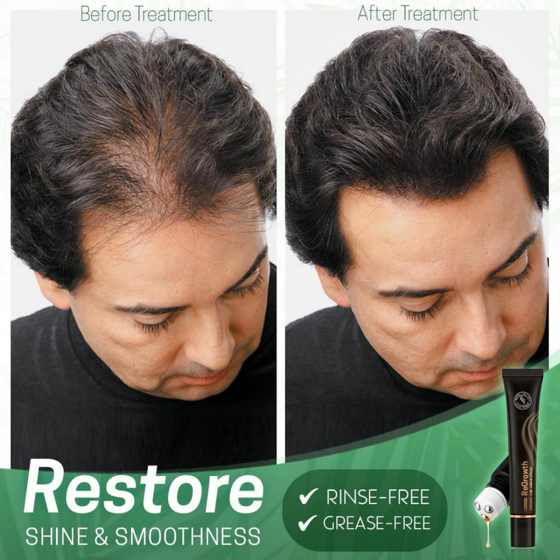 Regrow Bio-Haarserum™ | Stimuliere dein Haarwachstum 1+1 GRATIS