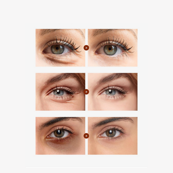 Cayman Augencreme™ | Die beste Lösung für müde Augen! (1+1 GRATIS)