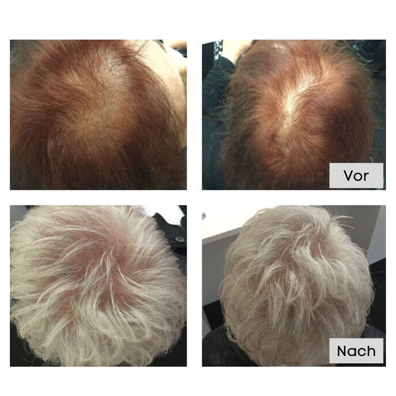 HariPure Regrow | Das neue Rezept für Haarwachstum